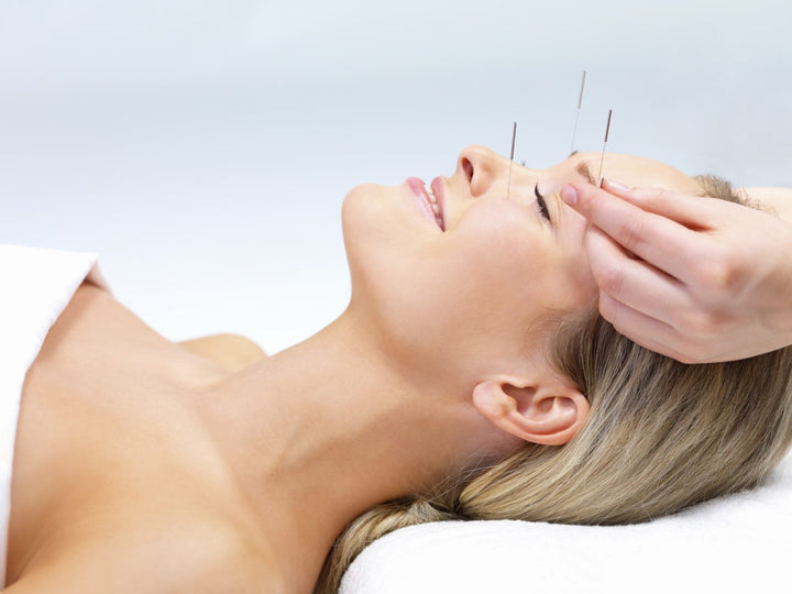 Acupuncture vs Botox: What Face Acupuncture did for me